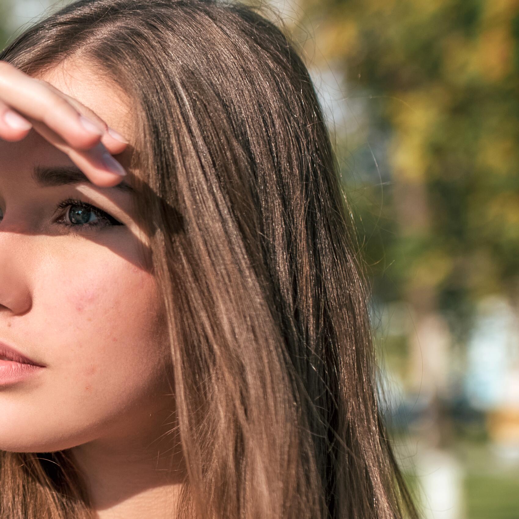 witte vlekken op het gezicht veroorzaakt door de zon
